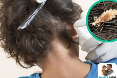 Cómo eliminar los piojos en 5 minutos con remedios caseros