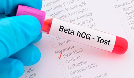 Análisis de sangre para detectar niveles de hCG
