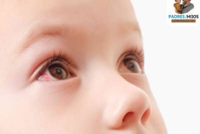 Conjuntivitis en niños: causas, síntomas y tratamiento