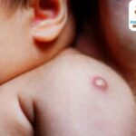 Plazo recomendado para administrar la vacuna de recién nacido