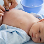 Cómo curar el ombligo de un recién nacido correctamente