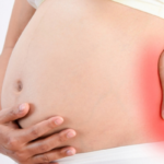 Alivio del dolor de espalda durante el embarazo: consejos y estrategias eficaces
